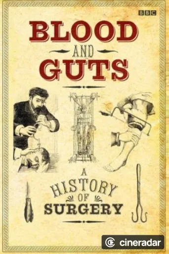 Blood and Guts: A History of Surgery